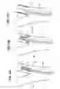 Fig. 29 - Baroreceptor testing prior to implantation methods and apparatus