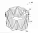 Fig. 01 - Sinus and nasal stent