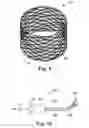 Fig. 06 - Sinus and nasal stent
