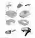 Fig. 02 - Devices, Methods and Systems to Implant and Secure an Intervertebral Implant for Spinal Treatment