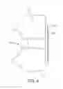 Fig. 06 - Flexible adjustable radiopaque trial, plate and method of use