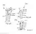 Fig. 08 - Flexible adjustable radiopaque trial, plate and method of use