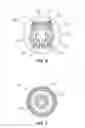 Fig. 06 - Implantable weight control device to promote early and prolonged satiety in a bariatric patient