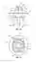 Fig. 09 - Implantable weight control device to promote early and prolonged satiety in a bariatric patient