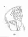 Fig. 08 - PRESCRIBED MOTION BRACE