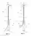 Fig. 07 - INTRA-UTERINE INSERTION DEVICE