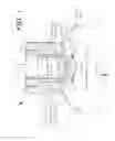 Fig. 02 - Ophthalmic incisional procedure instrument and method