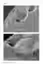 Fig. 02 - IMPLANTABLE DEVICES FOR TREATING HIV