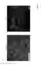 Fig. 10 - Compositions and methods for treating graft versus host disease