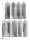 Fig. 15 - Compositions and methods for treating graft versus host disease