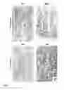 Fig. 17 - Compositions and methods for treating graft versus host disease