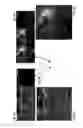 Fig. 07 - STEM CELL-DERIVED OLIGODENDROCYTE PROGENITOR CELLS FOR THE TREATMENT OF WHITE MATTER STROKE