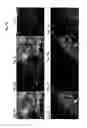 Fig. 08 - STEM CELL-DERIVED OLIGODENDROCYTE PROGENITOR CELLS FOR THE TREATMENT OF WHITE MATTER STROKE