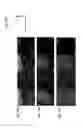Fig. 16 - STEM CELL-DERIVED OLIGODENDROCYTE PROGENITOR CELLS FOR THE TREATMENT OF WHITE MATTER STROKE