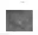 Fig. 06 - Emulsions or microemulsions for use in endoscopic mucosal resectioning and/or endoscopic submucosal dissection