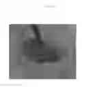 Fig. 08 - Emulsions or microemulsions for use in endoscopic mucosal resectioning and/or endoscopic submucosal dissection