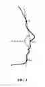 Fig. 02 - IMPLANTS FOR SCULPTING, AUGMENTING OR CORRECTING FACIAL FEATURES SUCH AS THE CHIN