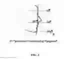 Fig. 03 - IMPLANTS FOR SCULPTING, AUGMENTING OR CORRECTING FACIAL FEATURES SUCH AS THE CHIN