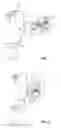 Fig. 02 - Device and method for expressing human breast milk