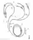 Fig. 09 - Peritoneal dialysis machine