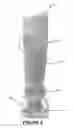Fig. 08 - Intraosseous injection device