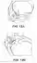 Fig. 08 - Lucid dream stimulator, systems, and related methods