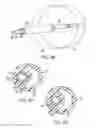 Fig. 07 - System and method for low-profile occlusion balloon catheter