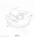 Fig. 09 - Catheter fixture