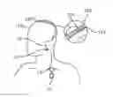 Fig. 01 - Medical device for sensing and or stimulating tissue
