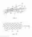 Fig. 07 - Medical device for sensing and or stimulating tissue