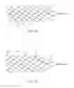 Fig. 08 - Medical device for sensing and or stimulating tissue
