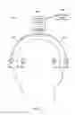 Fig. 33 - Implantable head located radiofrequency coupled neurostimulation system for head pain