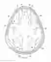 Fig. 35 - Implantable head located radiofrequency coupled neurostimulation system for head pain