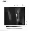 Fig. 06 - CELL STIMULATION METHOD AND CELL STIMULATION DEVICE