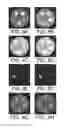Fig. 10 - Methods and systems for image-guided radiation therapy
