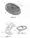 Fig. 09 - Tennis racquet with adjustable frame isolation
