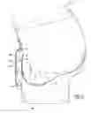 Fig. 04 - Groin area shield