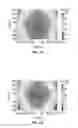 Fig. 06 - Optical cavity PCR