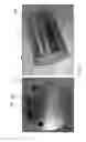 Fig. 06 - METHOD OF FORMING AN ELONGATED BODY WITH AN EMBEDDED CHANNEL