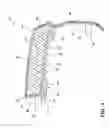 Fig. 04 - Armrest for a vehicle