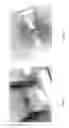 Fig. 04 - INSPECTION OF DEVICES MOUNTED ON AN ELEVATOR