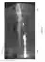 Fig. 32 - Double-staged oxy-fuel burner