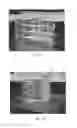 Fig. 08 - Method and system for printing 3D objects