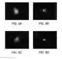 Fig. 09 - COMPOSITIONS, FORMULATIONS AND METHODS FOR TREATING OCULAR DISEASES