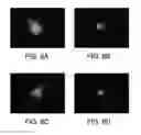 Fig. 09 - COMPOSITIONS, FORMULATIONS AND METHODS FOR TREATING OCULAR DISEASES