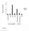 Fig. 05 - STAPHYLOCOCCAL ANTIGENS