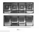 Fig. 02 - Attrition-resistant superabsorbent polymer, method for preparing the same and composition for preparing the same