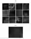 Fig. 07 - Methods for Neural Conversion of Human Embryonic Stem Cells