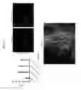 Fig. 35 - Methods for Neural Conversion of Human Embryonic Stem Cells