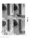 Fig. 08 - Capillary barriers for staged loading of microfluidic devices